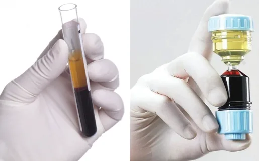 PRP preparation