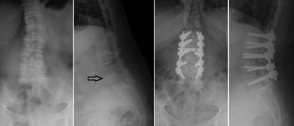 vertebra.webp