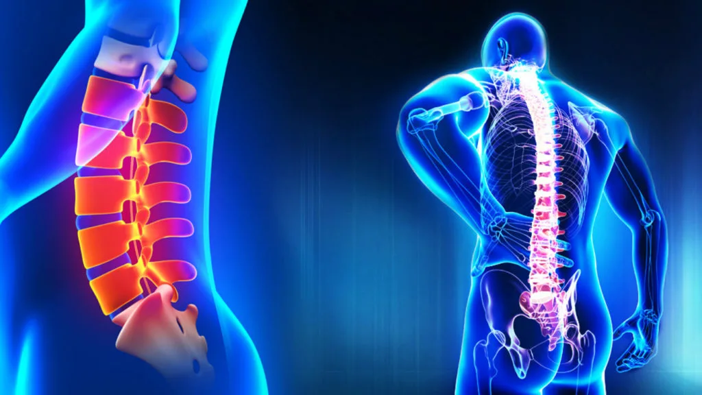 Spine Surgery